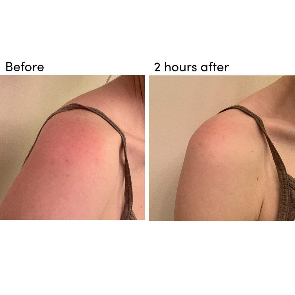 BODY 301: After-Sun Aloe Wipes (Pack of 15)