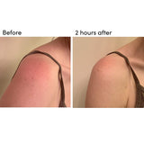 BODY 301: After-Sun Aloe Wipes (Pack of 15)